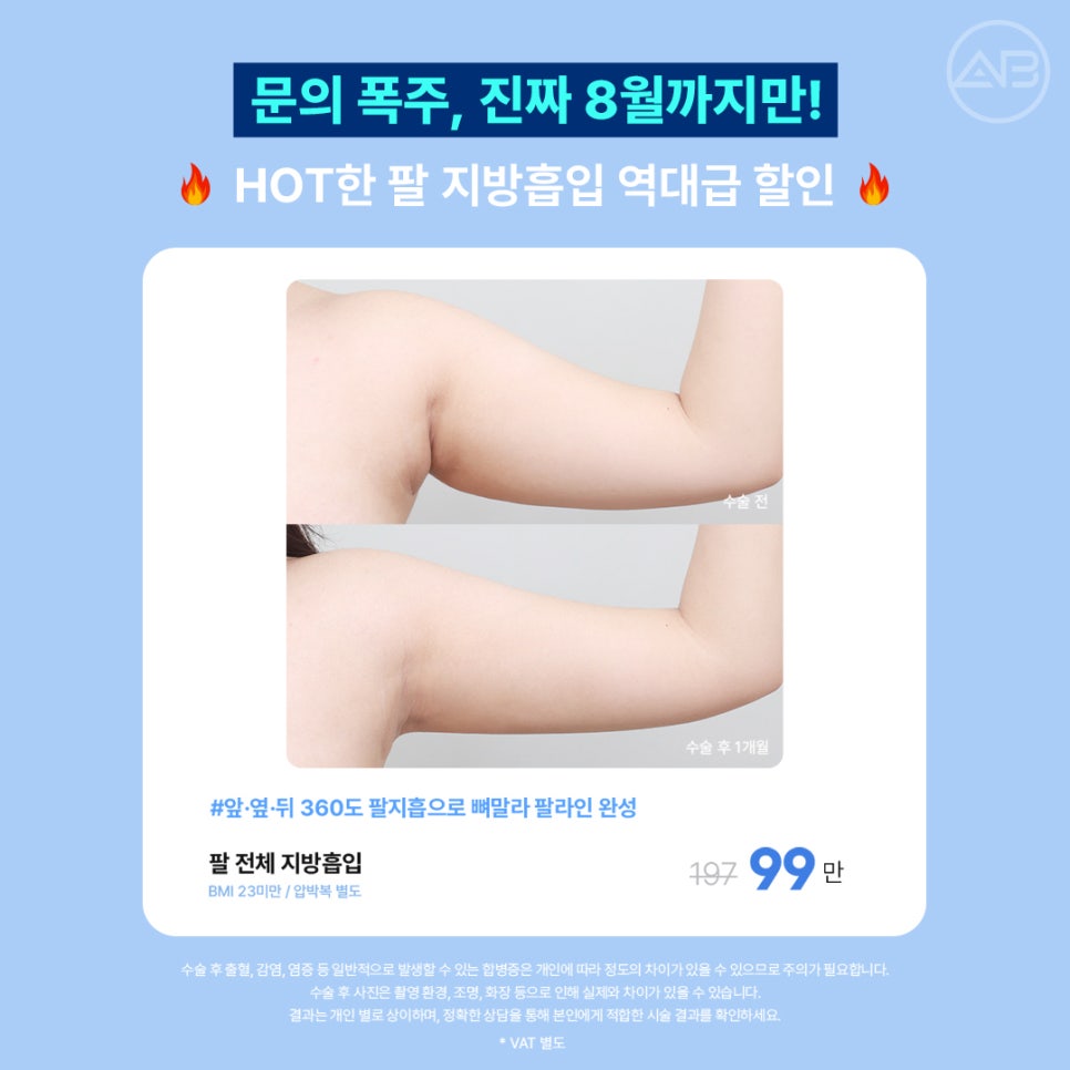 에이비성형외과 8월 여름 할인 이벤트 관련 이미지 3