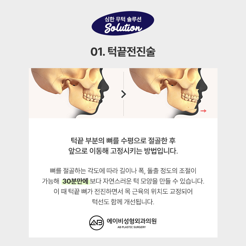 AB Plastic Surgery with Many Facial Contouring Reviews image 6