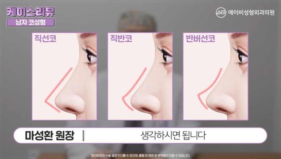 #에이비성형외과#에이비tv#케이스리뷰#남자코성형 관련 이미지 7