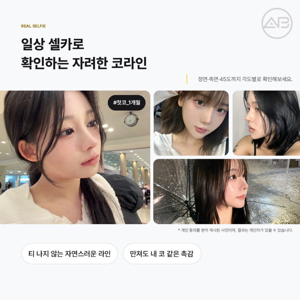 에이비성형외과 첫코 늑연골 채취 없이 비중격코성형으로 자연스럽게 관련 이미지 7