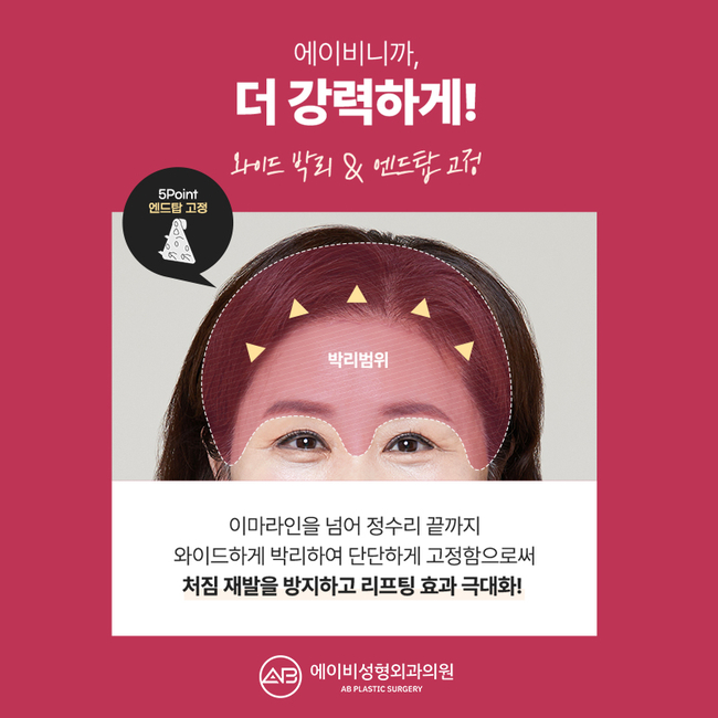 이마거상술가격 합리적으로 신중하게 선택하는 방법 관련 이미지 6
