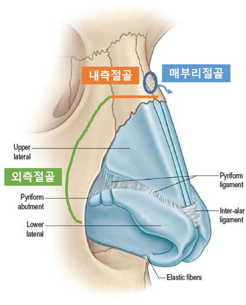 Q. 첫 코 고민 중인데 저는 절골이 필요한 코일까요? 관련 이미지 1