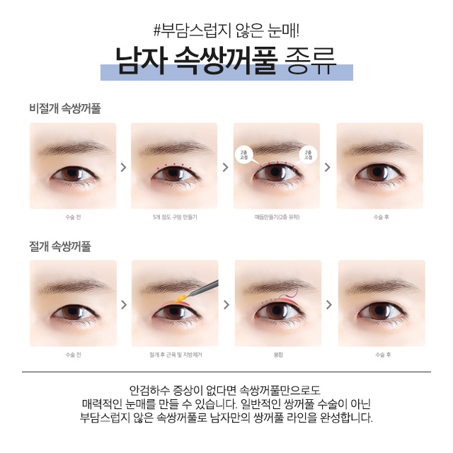 자연스러운 남자쌍꺼풀수술 에이비성형외과에서 만나 관련 이미지 5