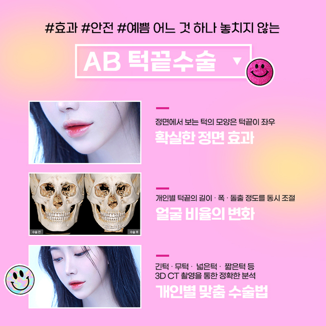 안면윤곽잘하는곳 어떻게 알아봐야할까요? 관련 이미지 5