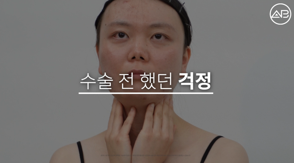 에이비성형외과 관련 이미지 6