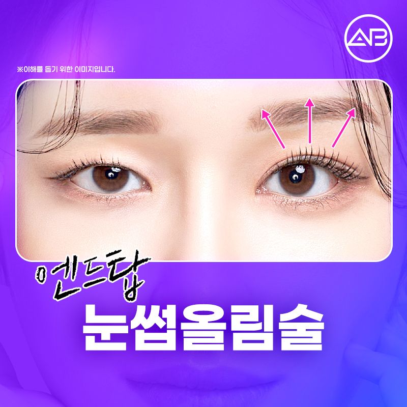 Curious About AB Plastic Surgery’s Brow Lift Surgery? image 1