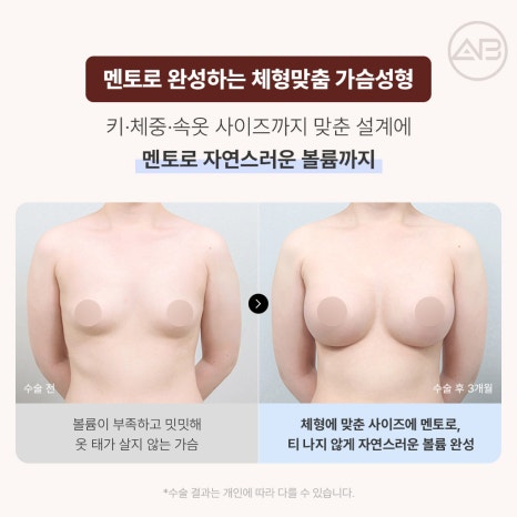 에이비성형외과 10월 자려한 가을이벤트 관련 이미지 7