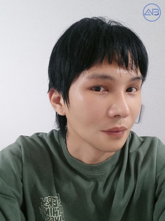 에이비성형외과 & 피부과 맥미남 (MAKE미남) 무국적내남자 관련 이미지 2