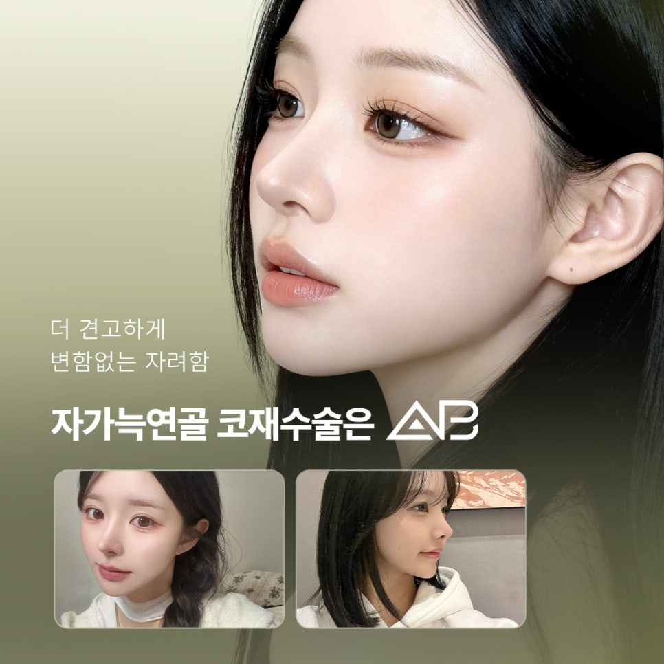 에이비성형외과 자가늑연골 비주라인 코재수술 시기와 교정 체크포인트 관련 이미지 18