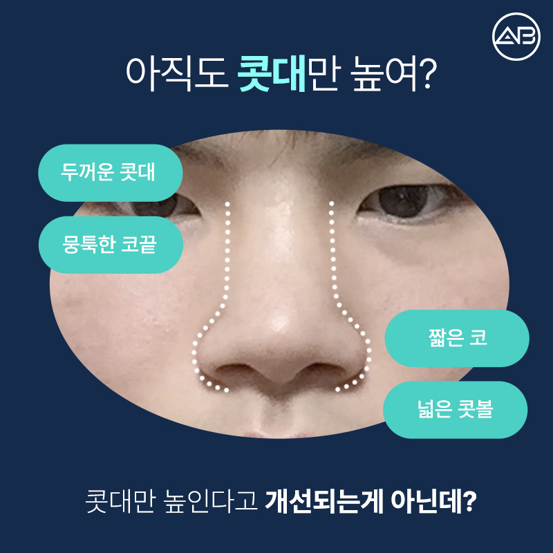 AB Plastic Surgery: What’s Different About an Elegant Male Straight Nose Surgery? image 2