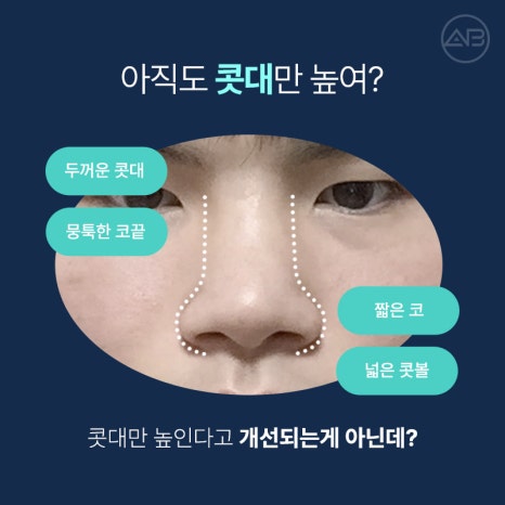 남자직선코성형 왜 에이비성형외과일까? 관련 이미지 2