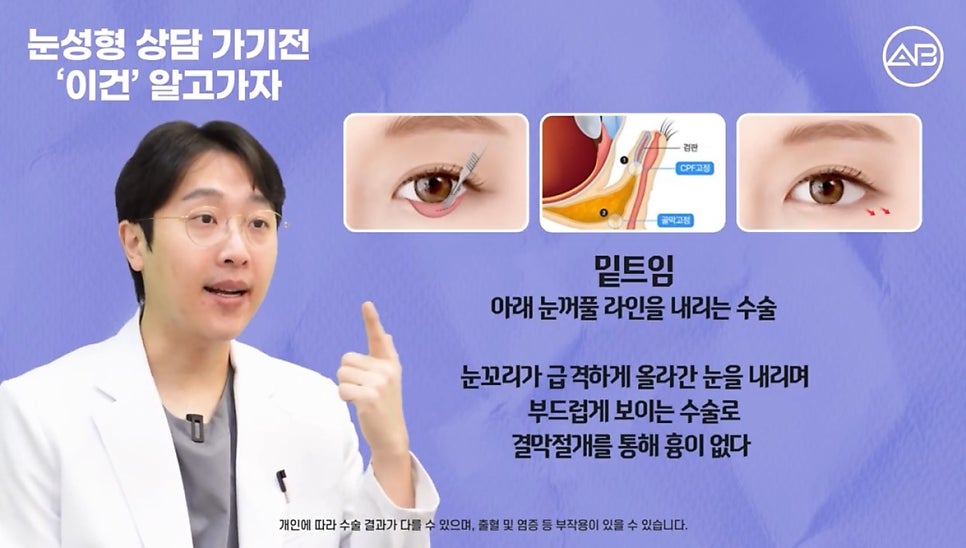 #AB Plastic Surgery #AB TV #Eye Surgery #Eye Surgery Terminology image 11