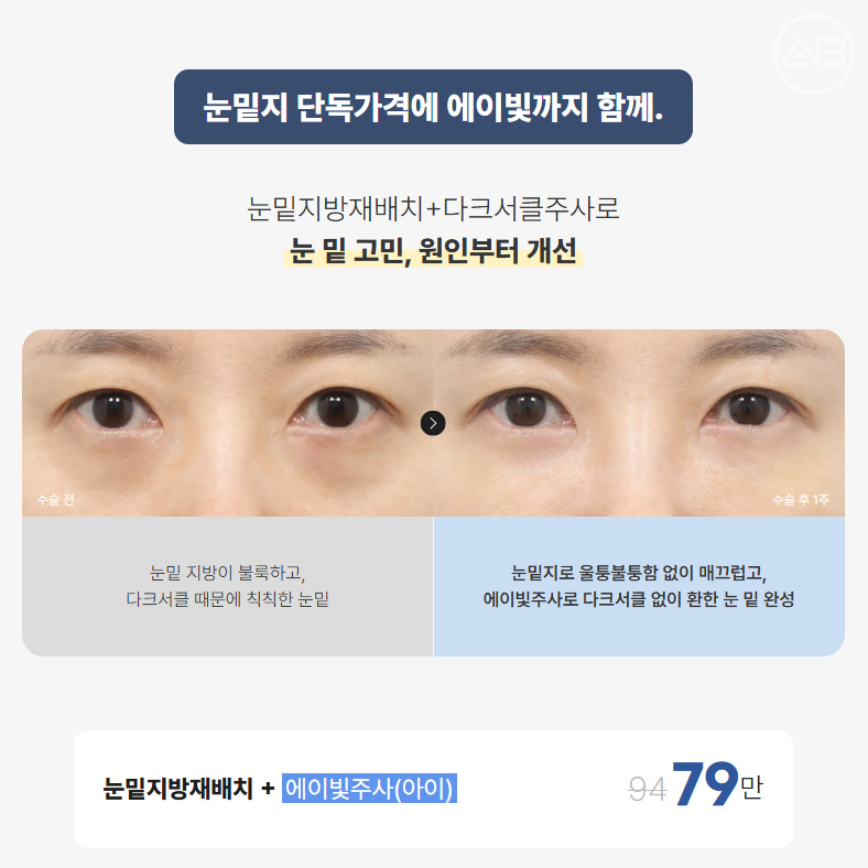 에이비성형외과 추석 기획전 눈밑, 3D 맞춤코성형 이벤트 관련 이미지 2