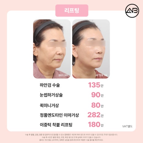 에이비성형외과 설렘 가득 봄 한정 49% 할인 이벤트 관련 이미지 10