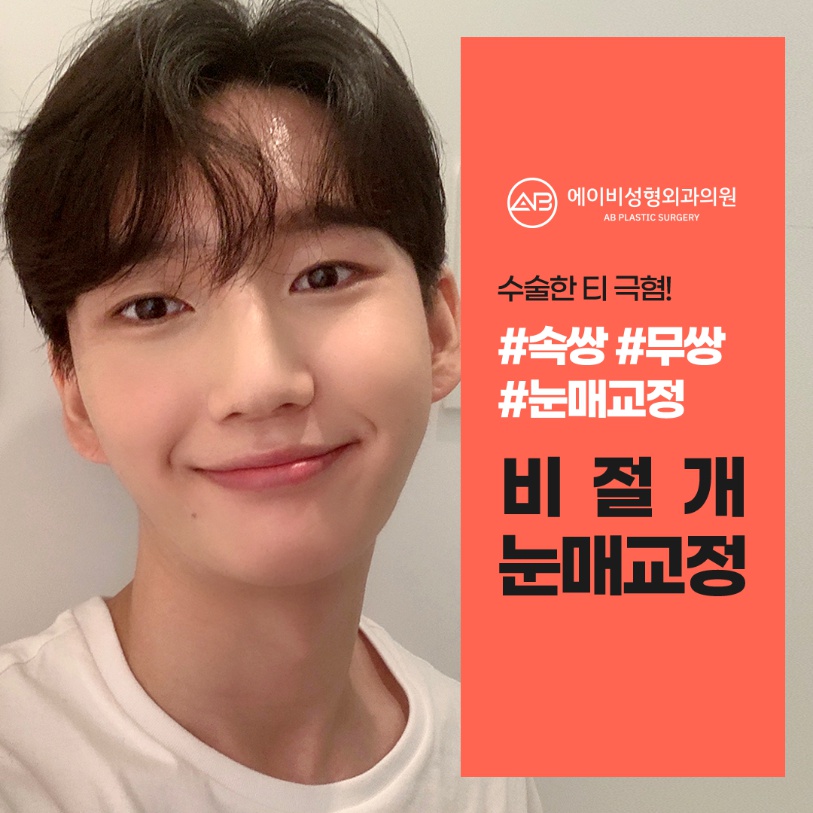 [칼럼] 짝눈인데, 한쪽만 수술받아도 괜찮을까요? 관련 이미지 5