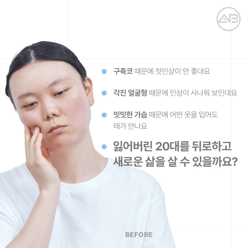 AB Plastic Surgery Contracted Nose Autologous Rib Short Nose Revision Correction Before and After image 3