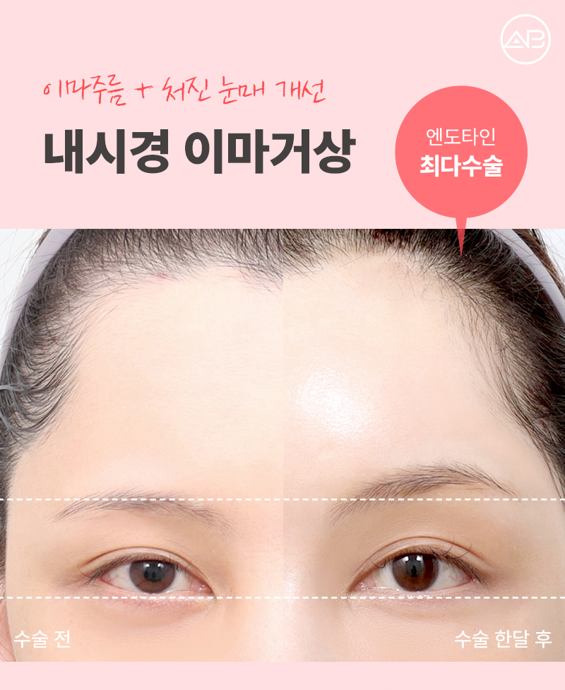 에이비성형외과 5월 황금연휴 이벤트 소식 관련 이미지 4