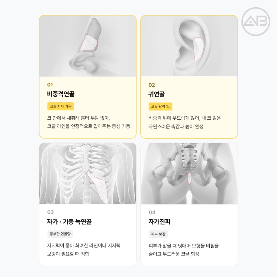 에이비성형외과 첫코 늑연골 채취 없이 비중격코성형으로 자연스럽게 관련 이미지 4