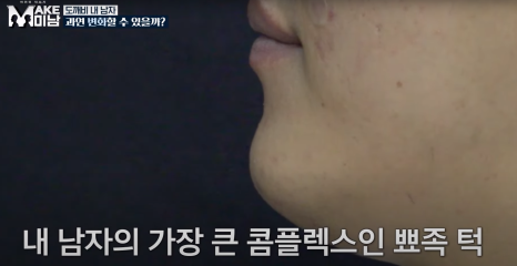 [에이비성형외과 방송출연] LG헬로비전&KBSjoy 관련 이미지 12