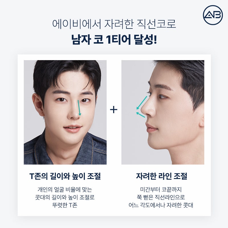 AB Plastic Surgery: What’s Different About an Elegant Male Straight Nose Surgery? image 4