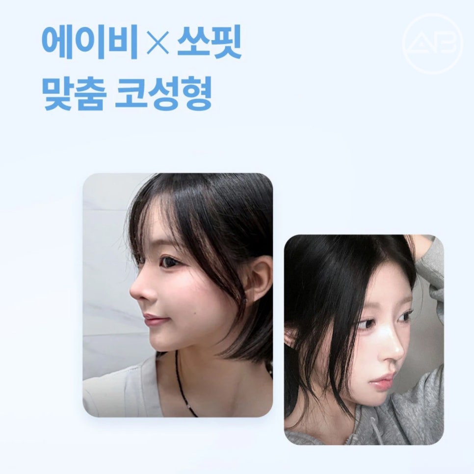 에이비성형외과 맞춤형보형물 쏘핏, 재수술 코의 비대칭과 변형까지 고려해 제작될까? 관련 이미지 1