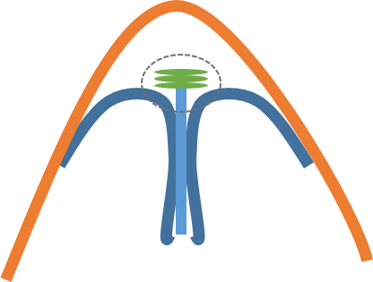 Q. I have a bulbous nose, but can’t it be improved with cartilage suturing or stacking alone? image 3