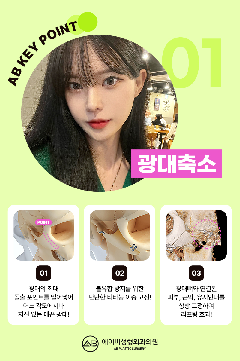 윤곽수술잘하는곳 볼 때 고려해야 할 점 관련 이미지 4