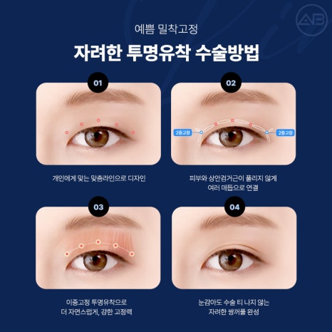 Transparent Adhesion for a Refined Look: AB Plastic Surgery for Attractive Eyes image 5