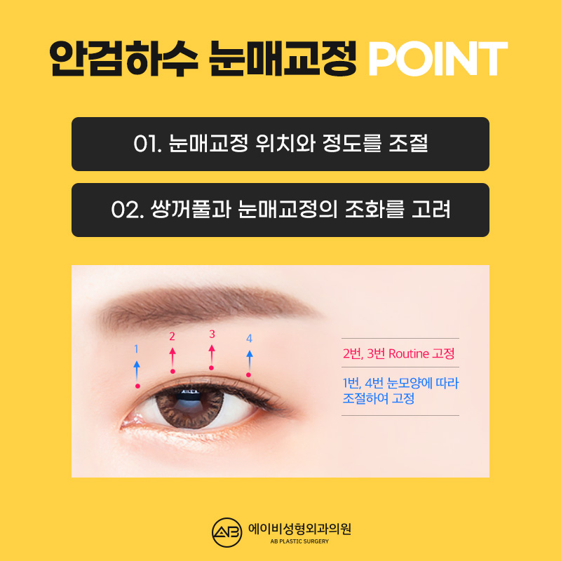 눈뜨는 힘이 부족하다면 에이비 안검하수눈매교정 관련 이미지 4