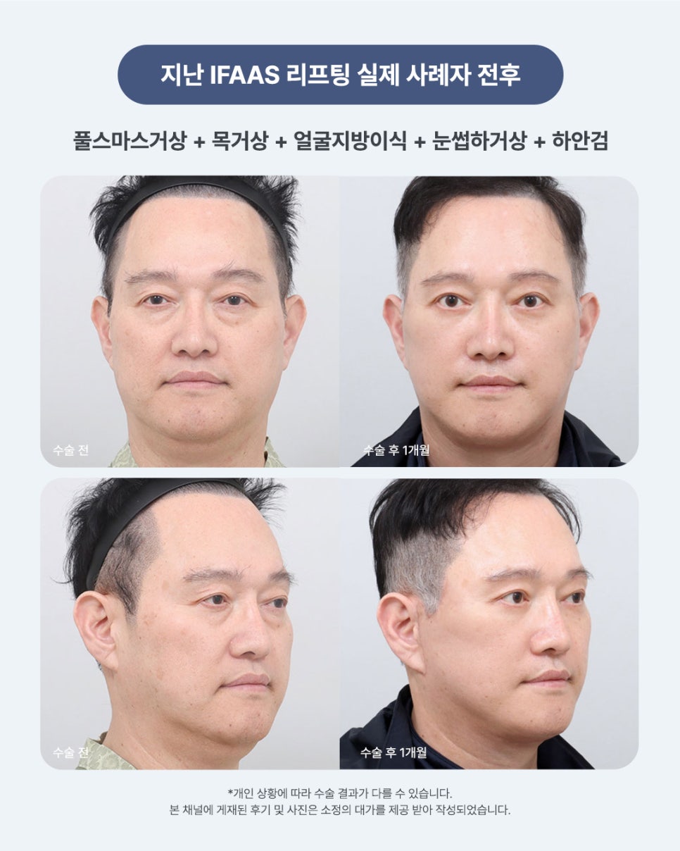 에이비성형외과 2026 리프팅 IFAAS 심포지엄 개최 관련 이미지 4