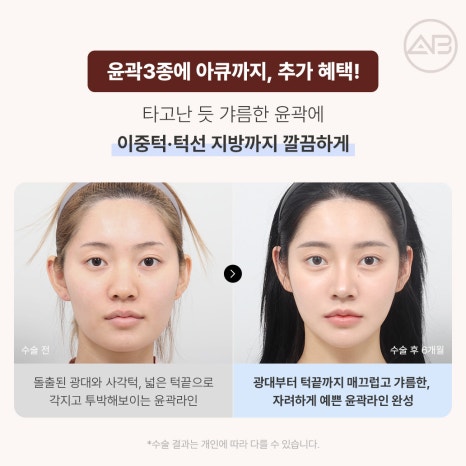 에이비성형외과 10월 자려한 가을이벤트 관련 이미지 6