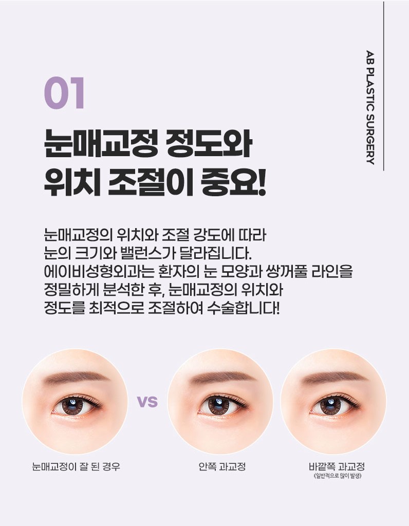 AB성형외과와 눈매교정수술전후 비교해보세요! 관련 이미지 4