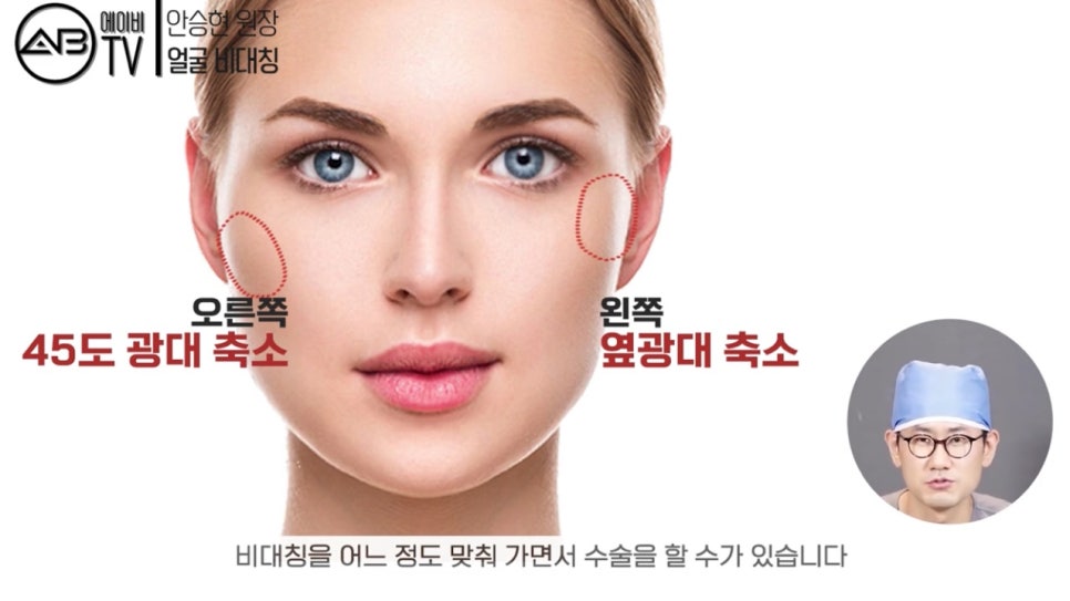 #에이비성형외과 #에이비TV #안면윤곽수술 #비대칭 관련 이미지 6