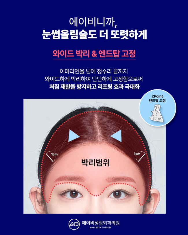 If You’re Still Thinking About a Brow Lift image 3