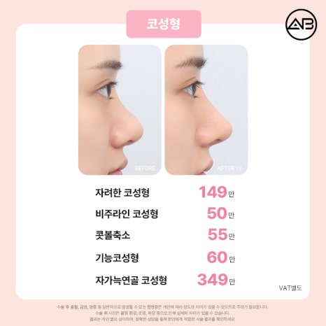 에이비성형외과 설렘 가득 봄 한정 49% 할인 이벤트 관련 이미지 8