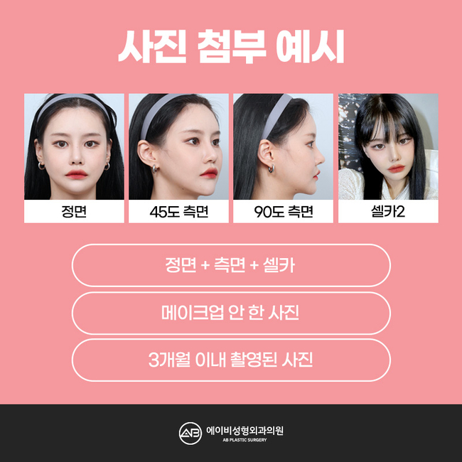 에이비성형외과 리얼모델 모집 안내 관련 이미지 4