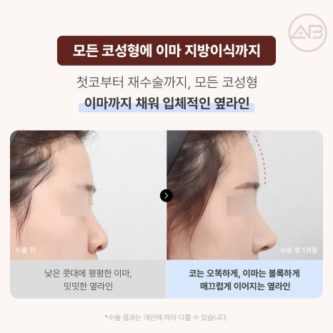 에이비성형외과 10월 자려한 가을이벤트 관련 이미지 5