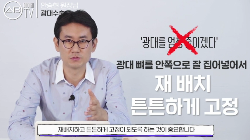 강남에이비성형외과 #유튜브 #에이비TV #광대수술 #광대축소술 관련 이미지 3