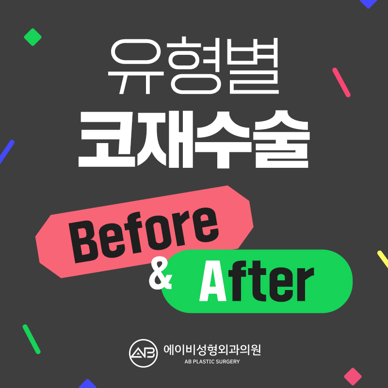코재수술성형외과 에이비만 믿어! 관련 이미지 6