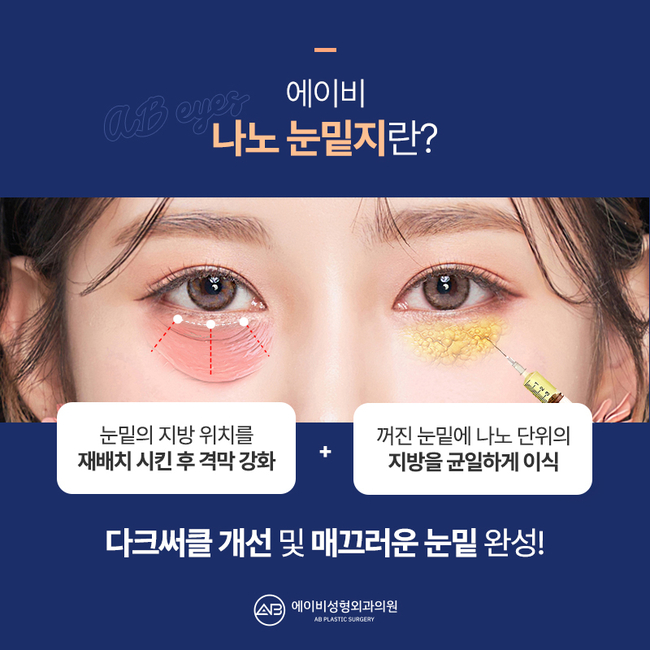 에이비 나노 눈밑지 이게 뭔데? 관련 이미지 4