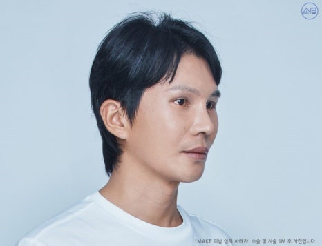에이비성형외과 & 피부과 맥미남 (MAKE미남) 무국적내남자 관련 이미지 4
