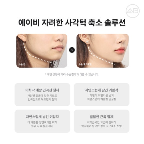 자연스럽고 조화로운 자려한안면윤곽을 원한다면 AB성형외과 관련 이미지 9
