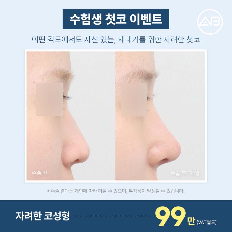 에이비성형외과 수능 끝! 2027 수험생 특별 이벤트 관련 이미지 4
