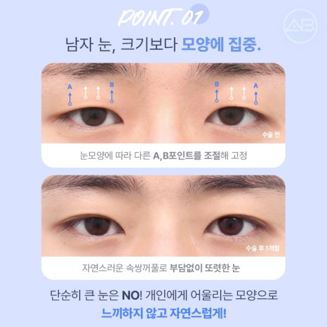 인상을 바꾸는 첫 시작, 에이비성형외과 남자눈성형 관련 이미지 6