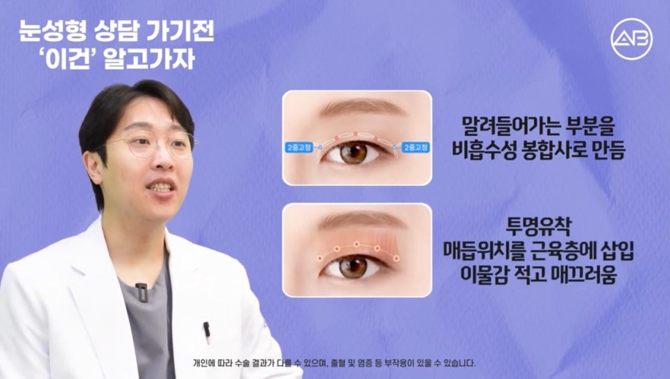 #AB Plastic Surgery #AB TV #Eye Surgery #Eye Surgery Terminology image 2