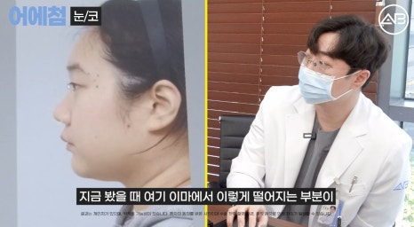 에이비성형외과 맥미걸(MAKEMEGirl) 맥미돌 코성형 상담 과정 관련 이미지 30