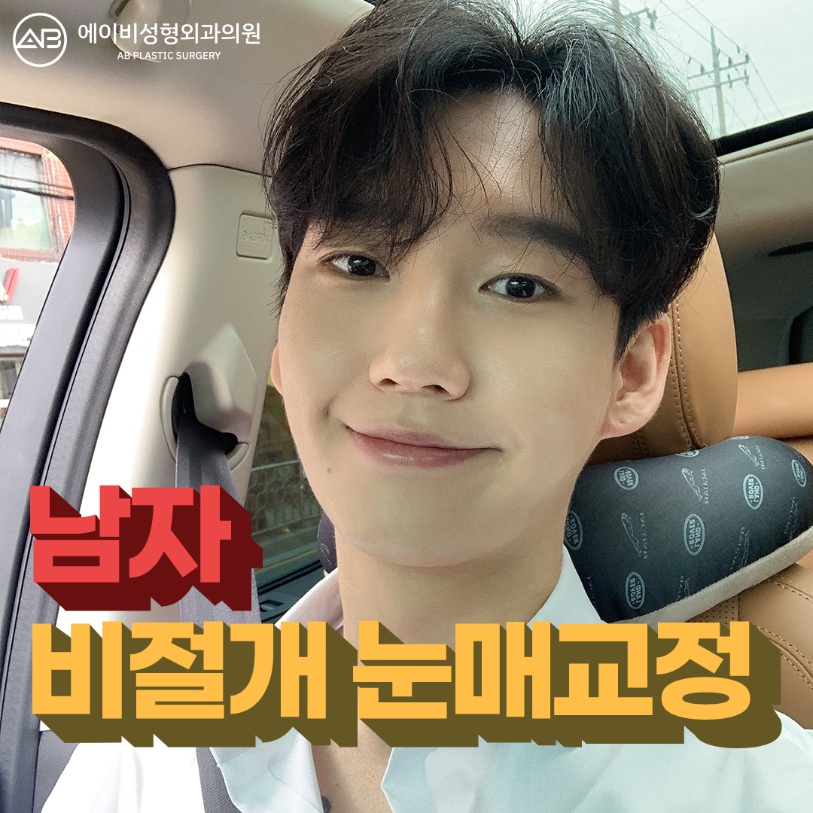[칼럼] 짝눈인데, 한쪽만 수술받아도 괜찮을까요? 관련 이미지 4