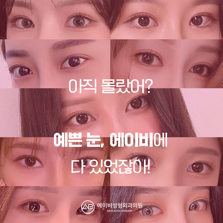 [칼럼] 눈성형 수술법 중 절개법은 부자연스러운가? 관련 이미지 2