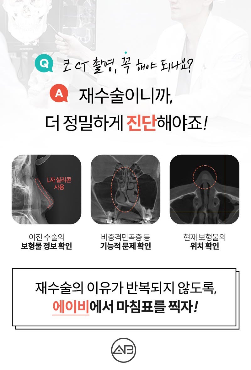 코재수술후기 에이비성형외과라면 다르지 관련 이미지 3