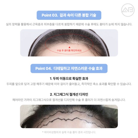 PRS KOREA 2024 : 에이비성형외과의 발표 내용과 성과 관련 이미지 9